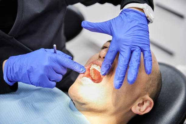 Best Emergency Wisdom Tooth Extraction in Meadow Oaks, FL